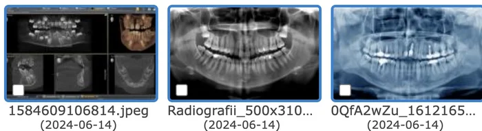 Radiografii în dROOT
