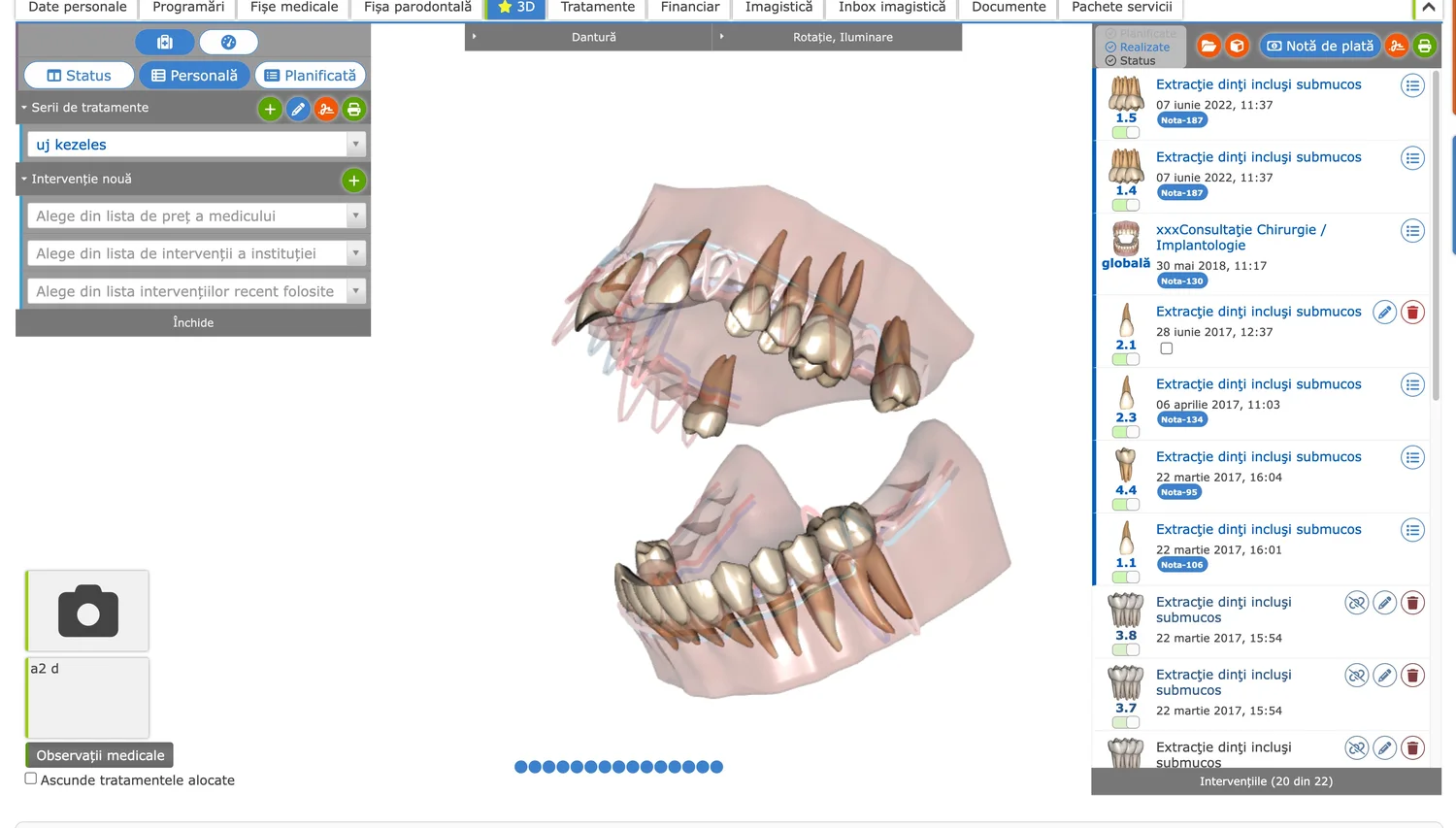 3D kezelési terv a dROOT alkalmazásban